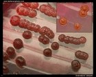 Enterobacter sakazakii on Endo